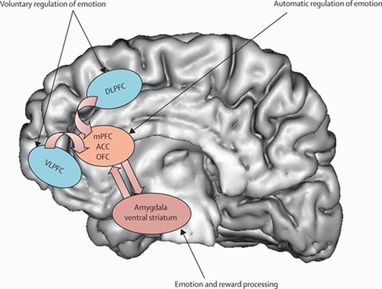 Antidepressant effects of magnetic resonance imaging--based stimulation on major depressive disorder: a double-blind randomized  {faces}